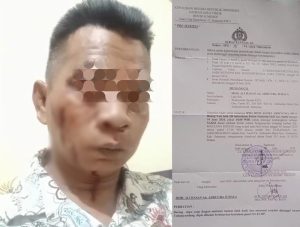 Viral !!! Kasus Pengeroyokan Wartawan, Di wilayah Hukum Polres Sumenep