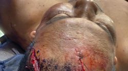 Ali Murdani Manurung Diborgol dalam Kondisi Luka Parah, Kuasa Hukum : “Ini Sudah Melampaui Batas.